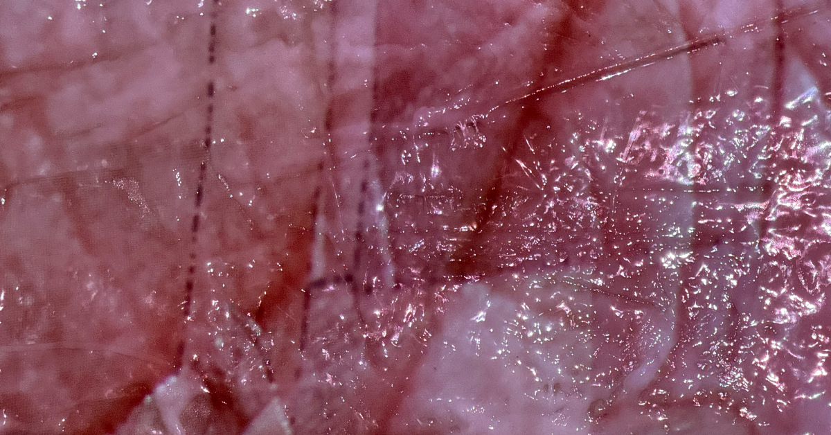 Interfacial Ecologies: On Bark, Bodies, and Bandwidth